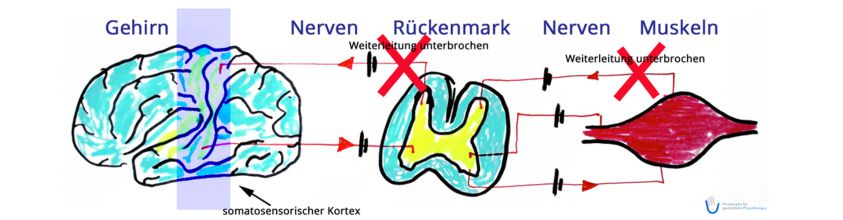 Grafik Sensomotorische Amnesie